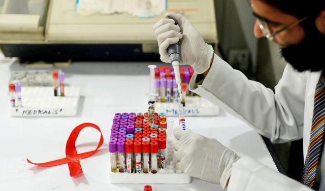 艾滋病已经能被治好了？明年临床试验，3700万患者有希望了！