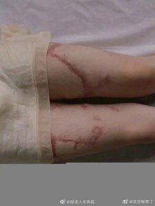 ​合肥16岁少女周岩因为拒绝富二代同学陶汝坤追求