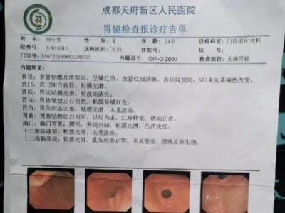 ​被罚吃“死神辣条”后就医！世界最辣的辣椒辣度是朝天椒的200倍