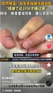 ​突然降温 女生手指被冻成白色 医生重要提醒