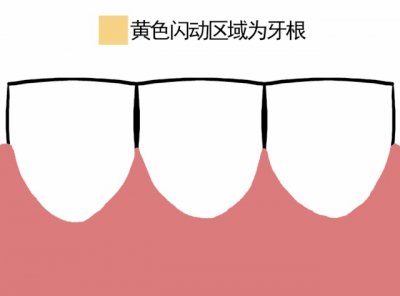 ​牙龈萎缩是怎么回事？如何预防？
