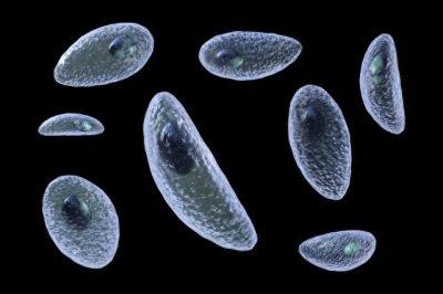 ​猪肉绦虫和水蛭都放在100℃的沸水里煮，哪一个会先被煮死？