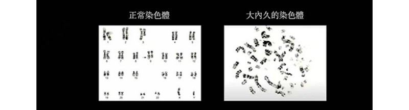 福岛核泄漏后人变异(被核辐射过的人体会变异成什么样)