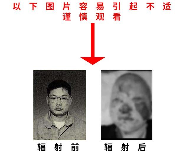 福岛核泄漏后人变异(被核辐射过的人体会变异成什么样)