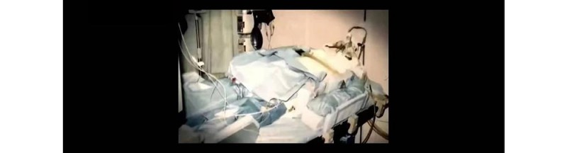 福岛核泄漏后人变异(被核辐射过的人体会变异成什么样)