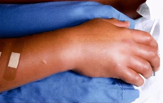 福岛核泄漏后人变异(被核辐射过的人体会变异成什么样)