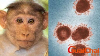 ​猴痘症状图片？猴痘怎么传染