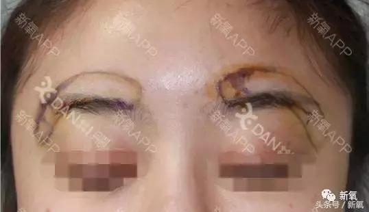 杨紫的美白方法（杨紫瘦了但这个部位却更丑了）(58)