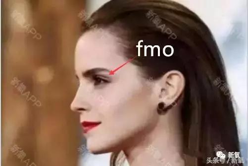 杨紫的美白方法（杨紫瘦了但这个部位却更丑了）(28)