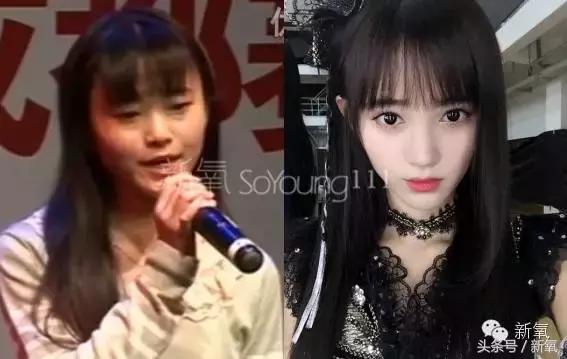 杨紫的美白方法（杨紫瘦了但这个部位却更丑了）(4)