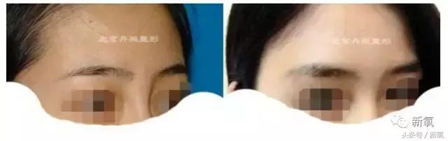 杨紫的美白方法（杨紫瘦了但这个部位却更丑了）(59)