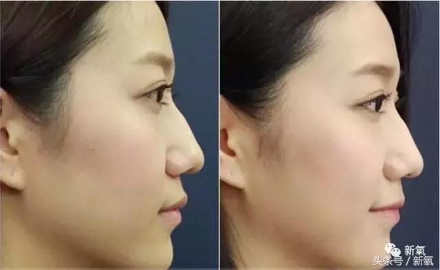 杨紫的美白方法（杨紫瘦了但这个部位却更丑了）(64)