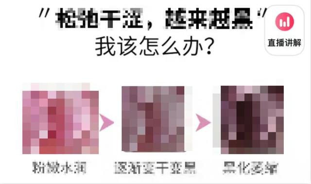 妇炎洁被下架的广告是什么（太黑太难闻下不去嘴）(13)