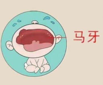 ​婴儿的“马牙”和“螳螂嘴”是啥？听起来可怕，到底要不要处理？