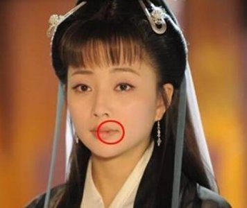 ​殷桃嘴上的痣怎么回事殷桃的嘴因它还曾引误会