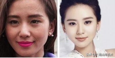 ​在高清镜头下，有一种“尴尬”叫卡粉